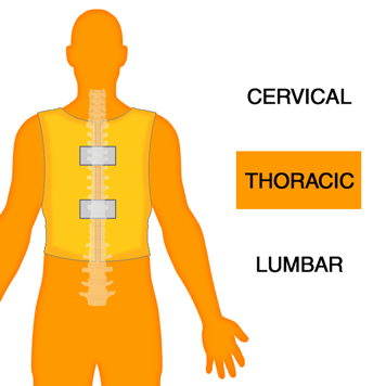 Thoracic Spine Orthotics Back Brace Image