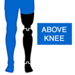 Above the Knee Prosthetic