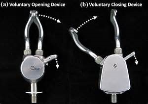 Voluntary Opening and Closing below elbow hand prosthesis